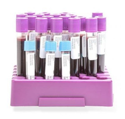 A purple tray with several blood tubes in it.